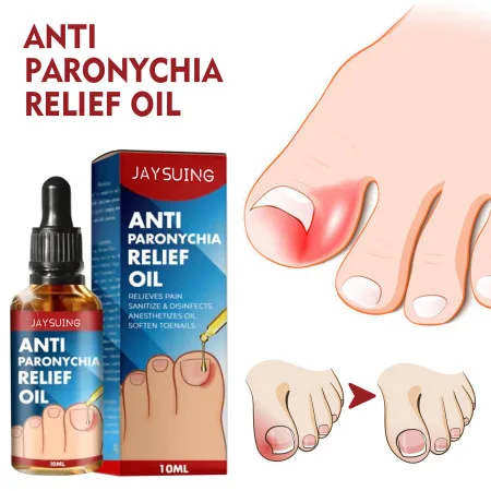 Anti Paronychia Relief Oil