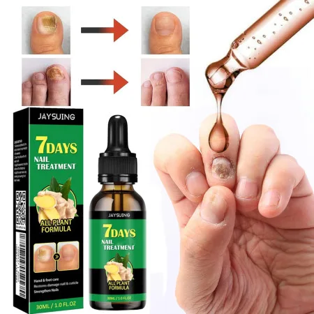 7 DAYS Nail Fungus Treatment Liquid