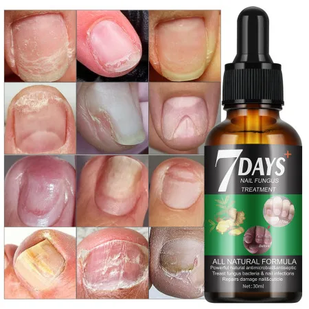 7 DAYS Nail Fungus Treatment Liquid