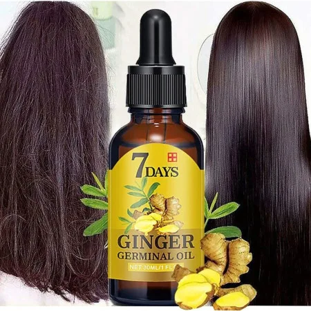 7 Days Ginger Hair Growth